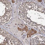 Atlas Antibodies Anti-WWC3 Antibody