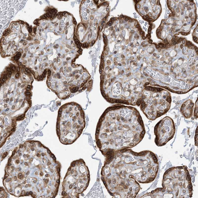 Atlas Antibodies Anti-WWP1 Antibody