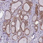 Atlas Antibodies Anti-WWOX Antibody