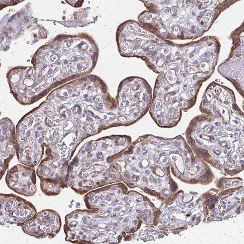 Atlas Antibodies Anti-XAGE2 Antibody