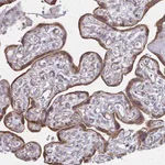 Atlas Antibodies Anti-XAGE2 Antibody