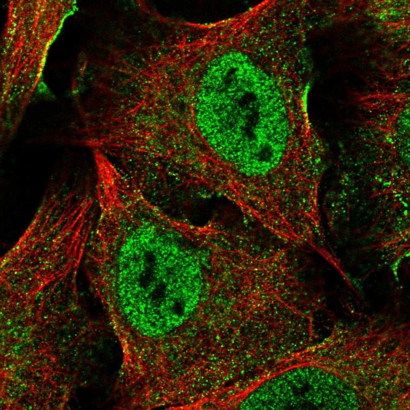Atlas Antibodies Anti-XAGE5 Antibody