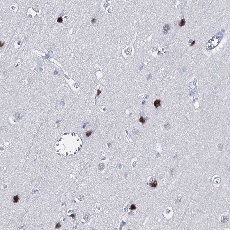 Atlas Antibodies Anti-XAGE3 Antibody