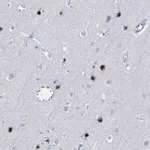 Atlas Antibodies Anti-XAGE3 Antibody