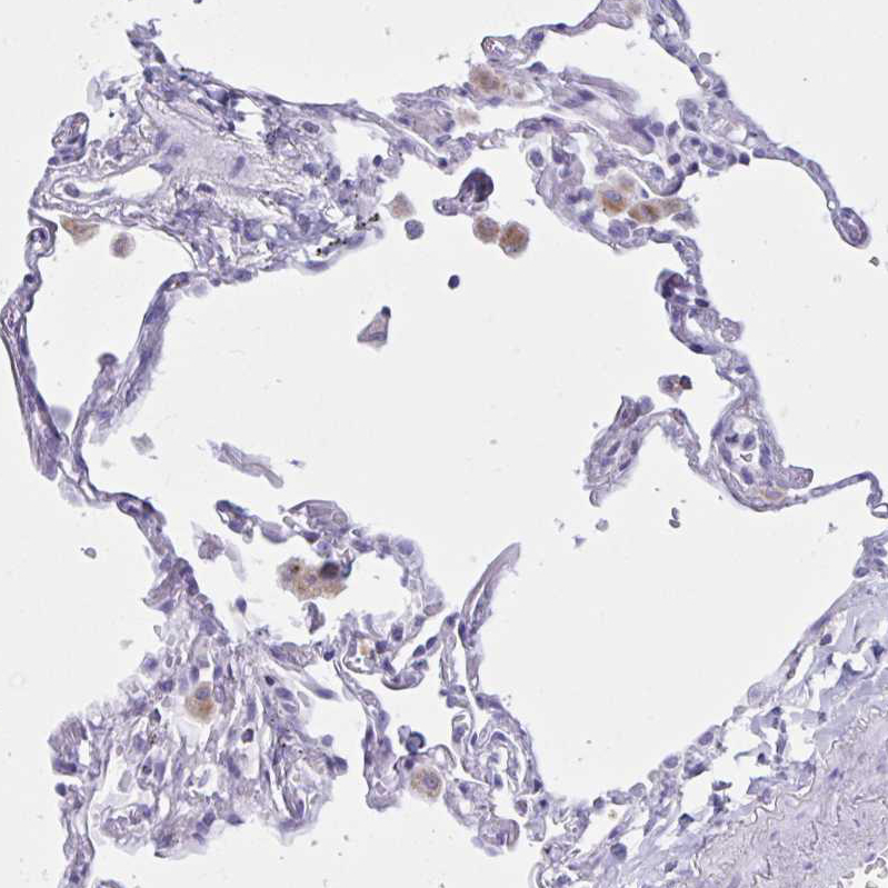 Atlas Antibodies Anti-XCL1 Antibody