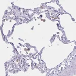 Atlas Antibodies Anti-XCL1 Antibody