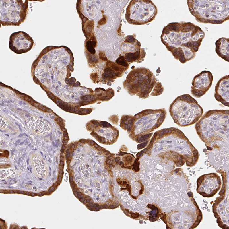 Atlas Antibodies Anti-XAGE2 Antibody