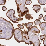 Atlas Antibodies Anti-XAGE2 Antibody