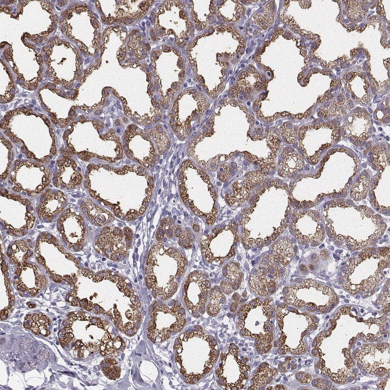 Atlas Antibodies Anti-XDH Antibody