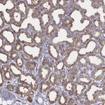 Atlas Antibodies Anti-XDH Antibody