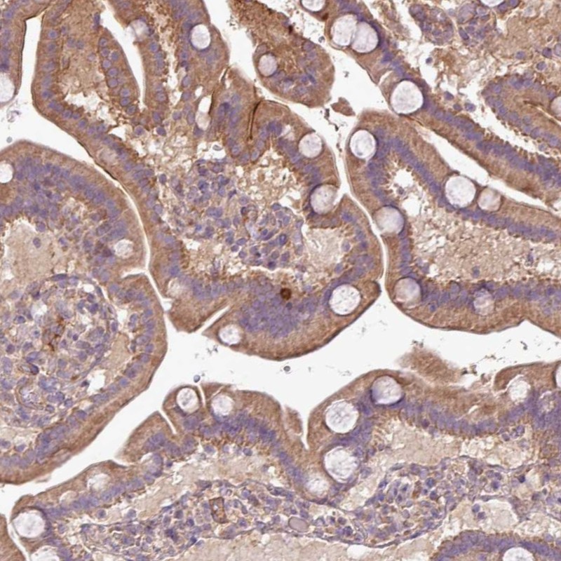 Atlas Antibodies Anti-XIAP Antibody