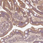 Atlas Antibodies Anti-XIAP Antibody
