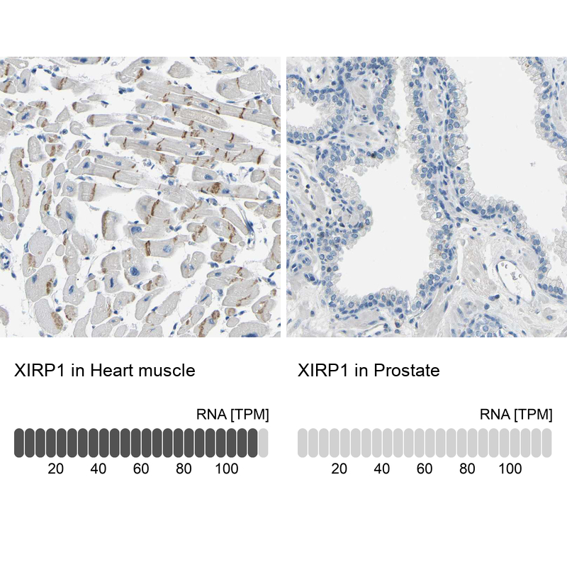 Atlas Antibodies Anti-XIRP1 Antibody
