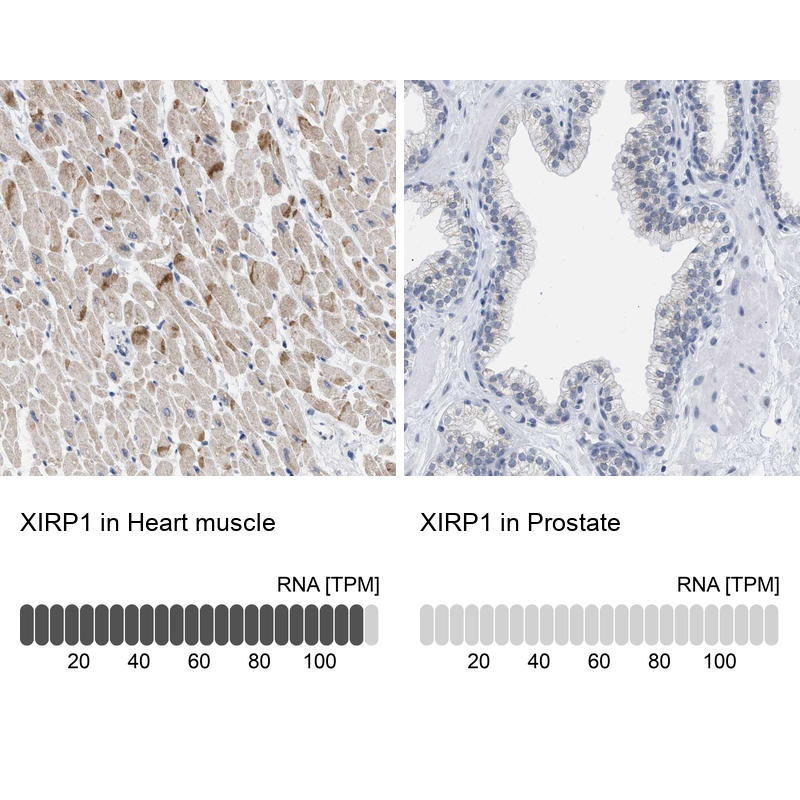 Atlas Antibodies Anti-XIRP1 Antibody