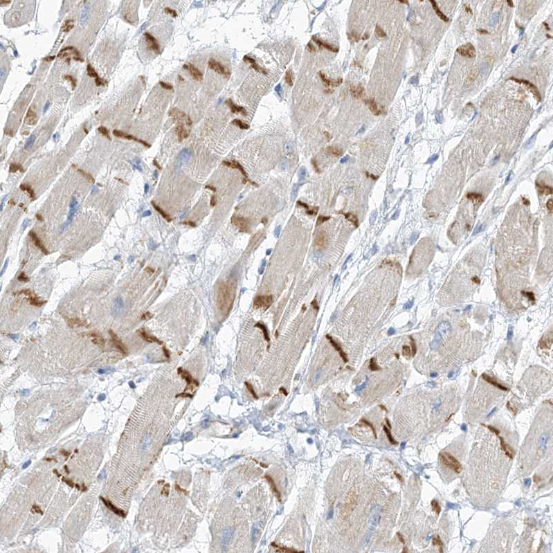 Atlas Antibodies Anti-XIRP2 Antibody