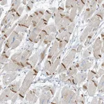 Atlas Antibodies Anti-XIRP2 Antibody