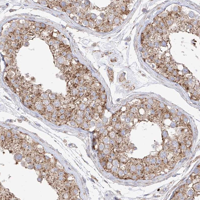 Atlas Antibodies Anti-XKR3 Antibody