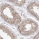 Atlas Antibodies Anti-XKR3 Antibody