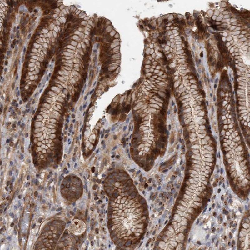 Atlas Antibodies Anti-XKR6 Antibody