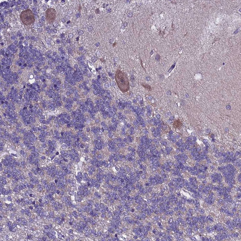 Atlas Antibodies Anti-XKR7 Antibody