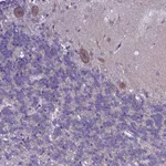 Atlas Antibodies Anti-XKR7 Antibody
