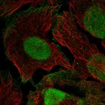 Atlas Antibodies Anti-XPC Antibody