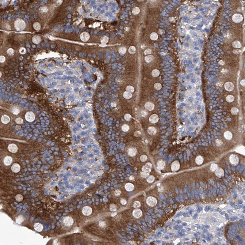 Atlas Antibodies Anti-XPNPEP1 Antibody