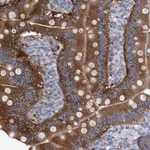 Atlas Antibodies Anti-XPNPEP1 Antibody
