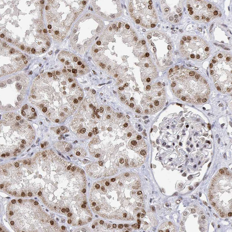 Atlas Antibodies Anti-XPC Antibody