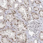 Atlas Antibodies Anti-XPC Antibody