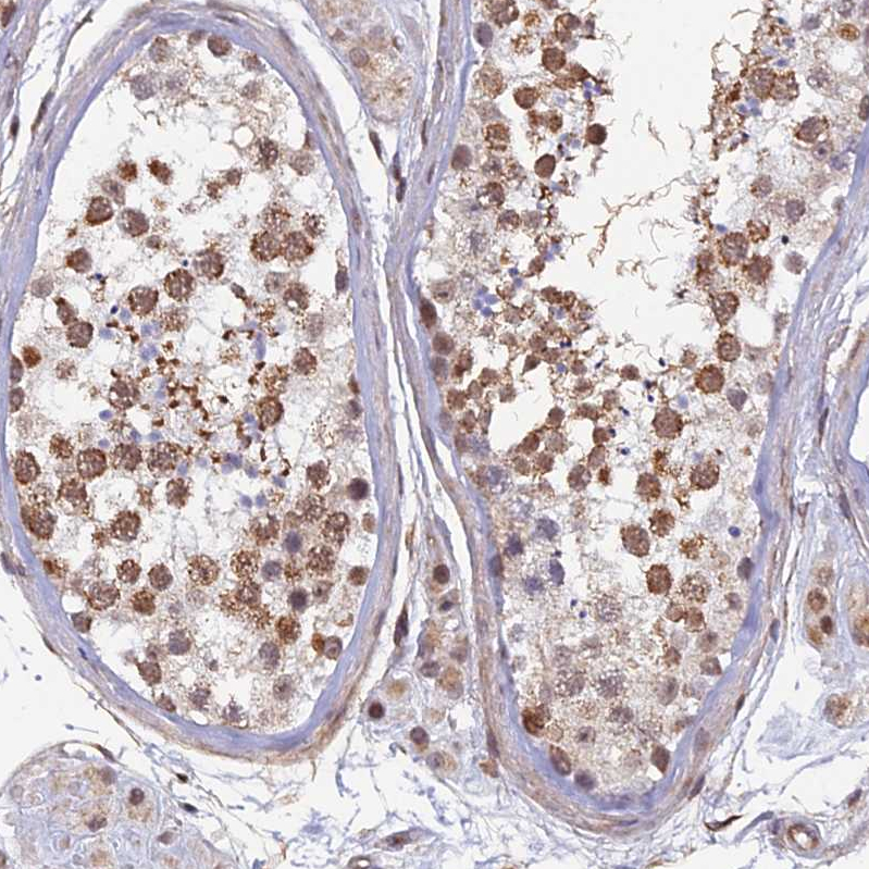 Atlas Antibodies Anti-XKR9 Antibody