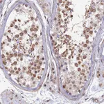 Atlas Antibodies Anti-XKR9 Antibody