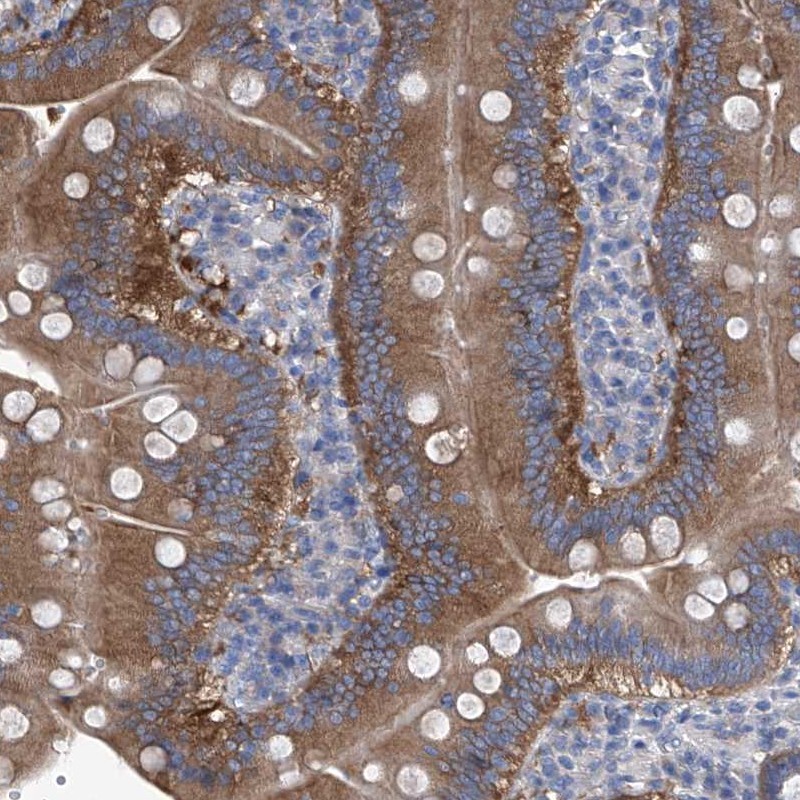 Atlas Antibodies Anti-XPNPEP1 Antibody