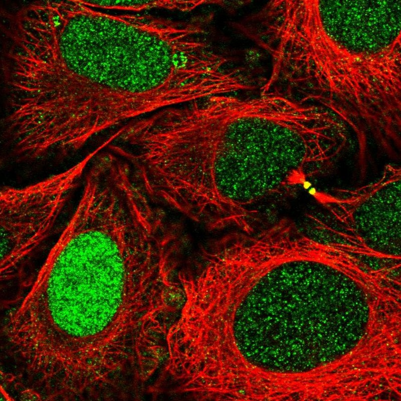 Atlas Antibodies Anti-XPA Antibody