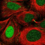 Atlas Antibodies Anti-XPA Antibody