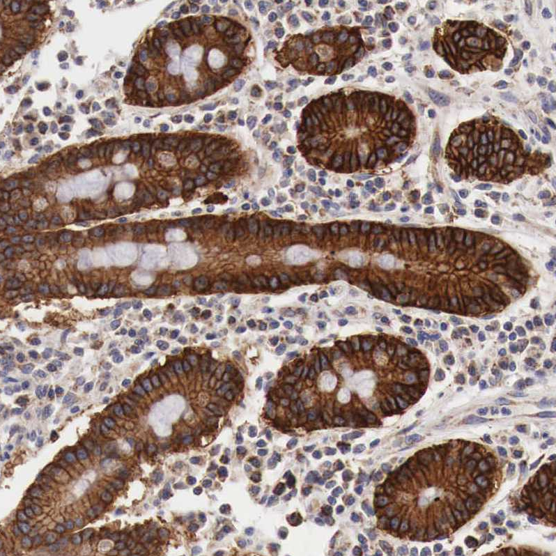 Atlas Antibodies Anti-XPNPEP3 Antibody
