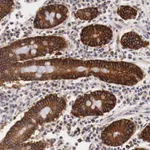 Atlas Antibodies Anti-XPNPEP3 Antibody