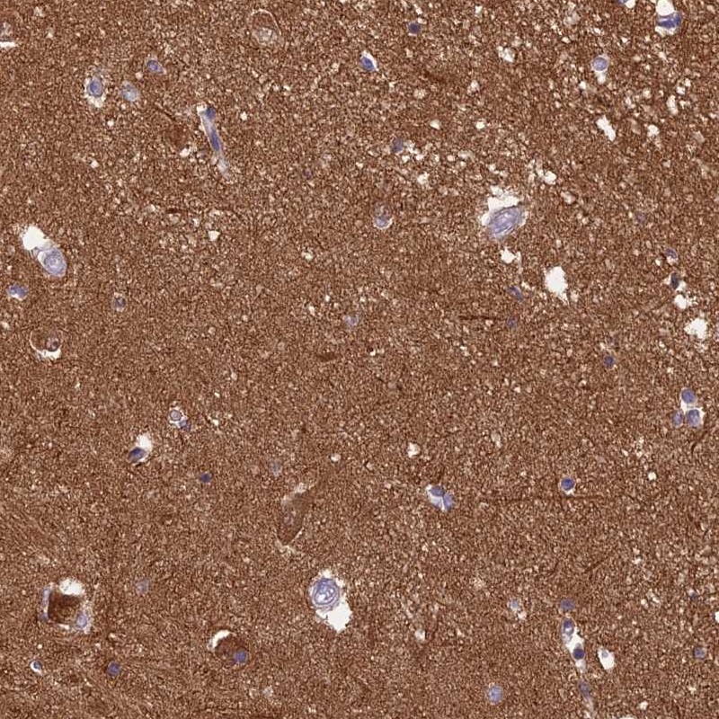 Atlas Antibodies Anti-XPO7 Antibody