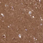 Atlas Antibodies Anti-XPO7 Antibody