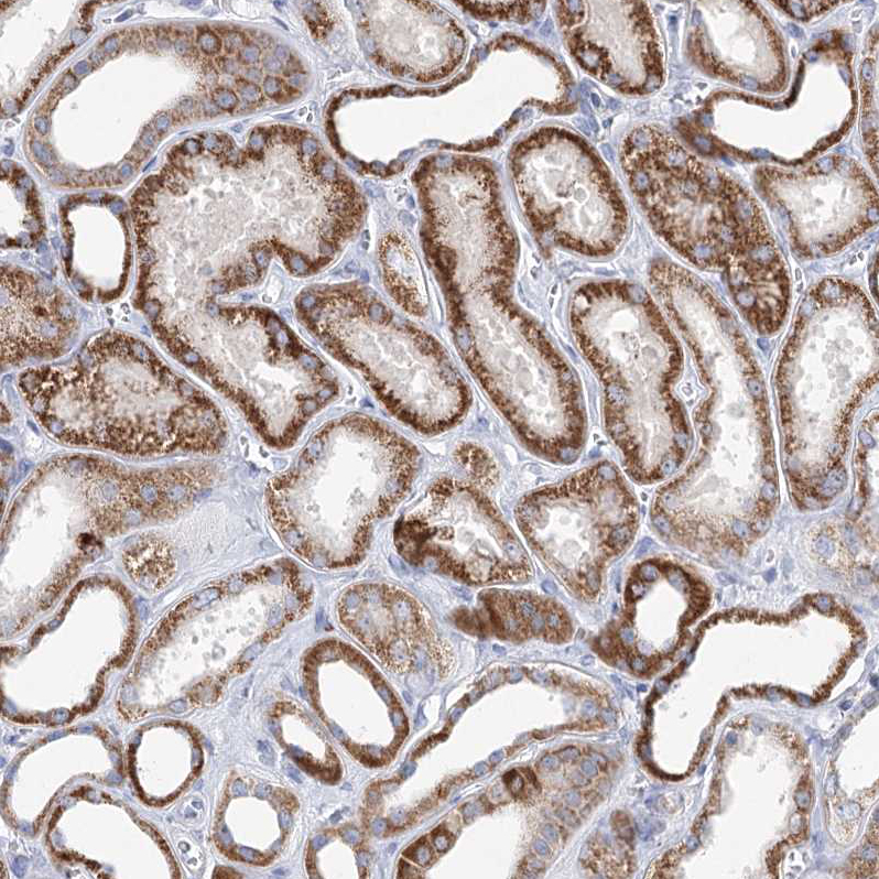 Atlas Antibodies Anti-XPO6 Antibody