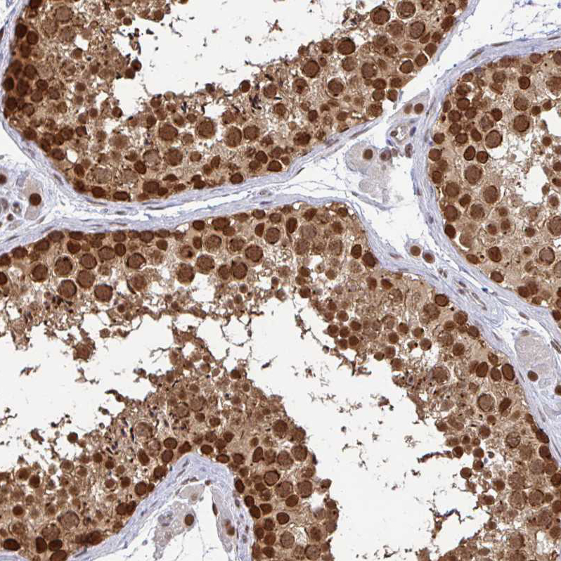 Atlas Antibodies Anti-XPO1 Antibody