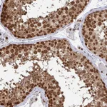 Atlas Antibodies Anti-XPO1 Antibody