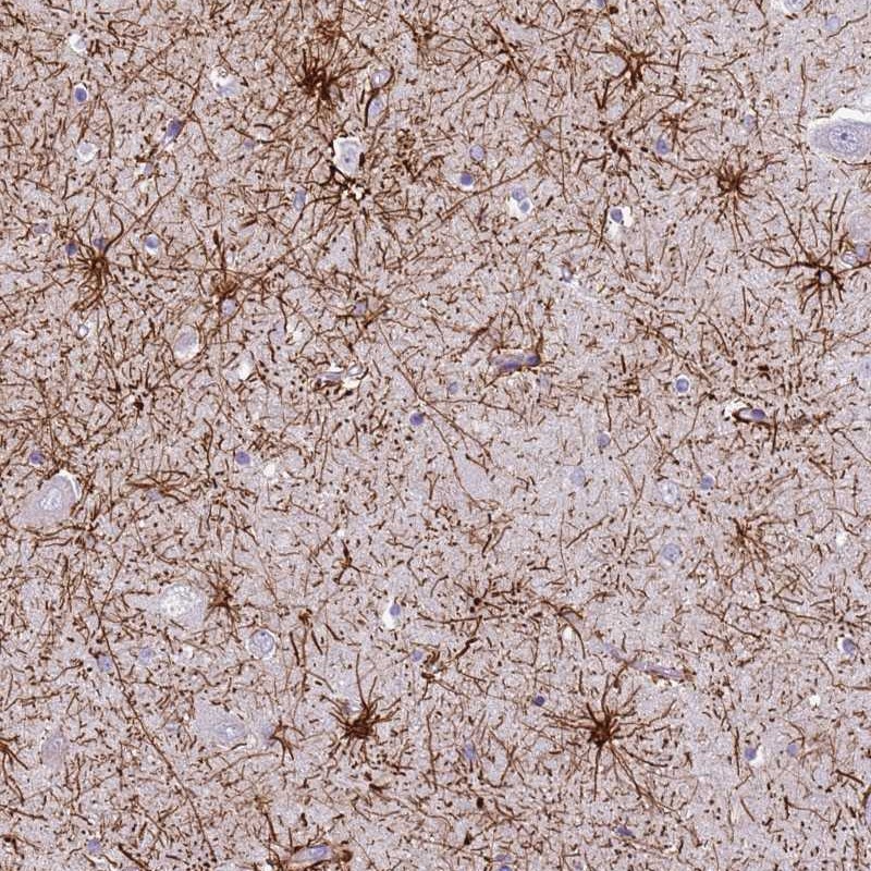 Atlas Antibodies Anti-XPO7 Antibody