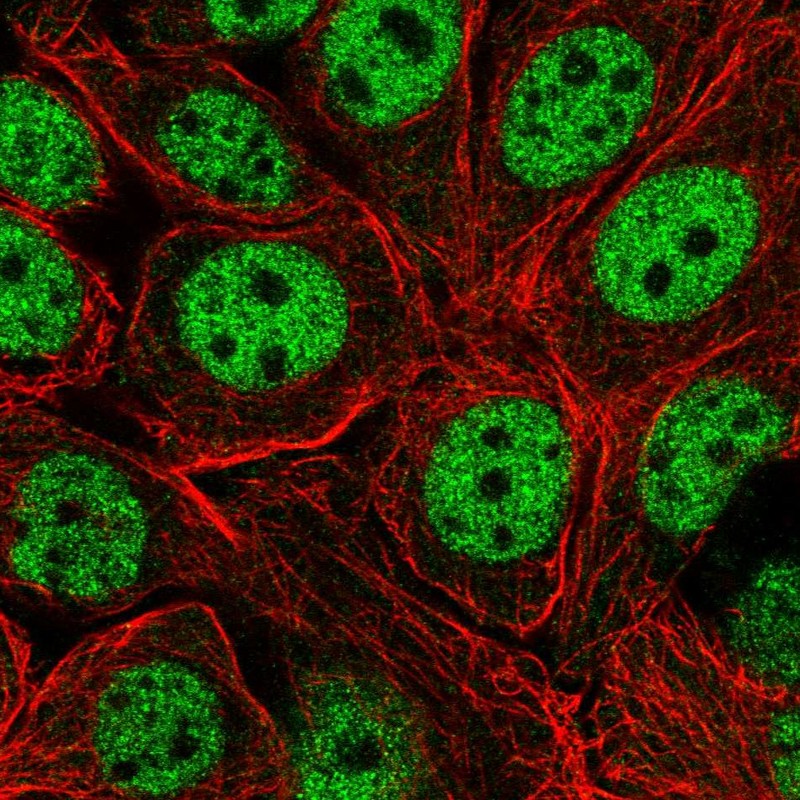 Atlas Antibodies Anti-XPOT Antibody