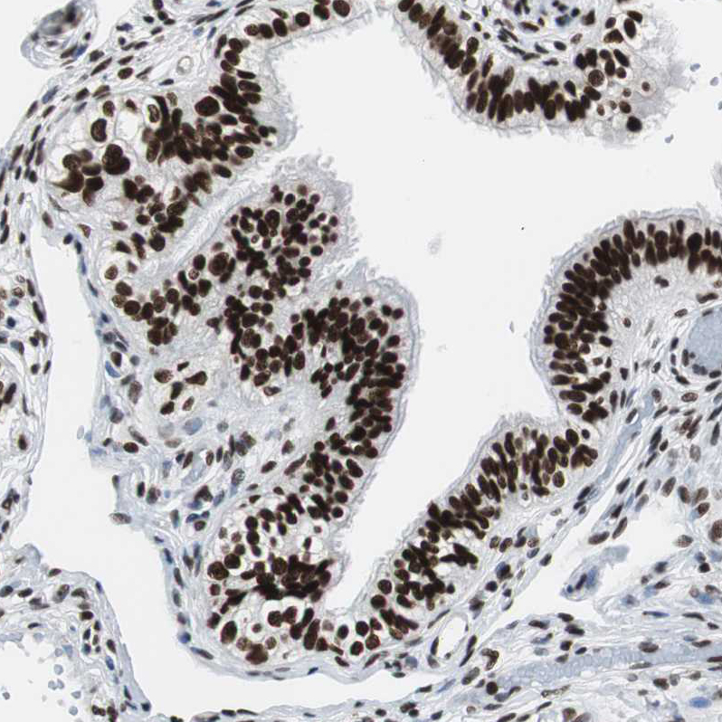 Atlas Antibodies Anti-XRCC1 Antibody