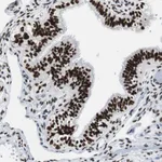 Atlas Antibodies Anti-XRCC1 Antibody