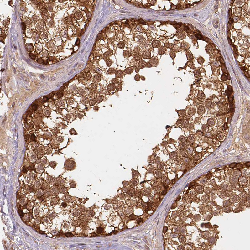 Atlas Antibodies Anti-XPR1 Antibody