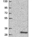 Atlas Antibodies Anti-XRCC3 Antibody