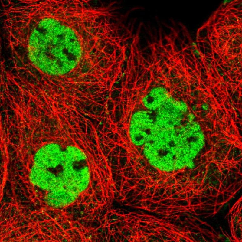 Atlas Antibodies Anti-XRCC4 Antibody