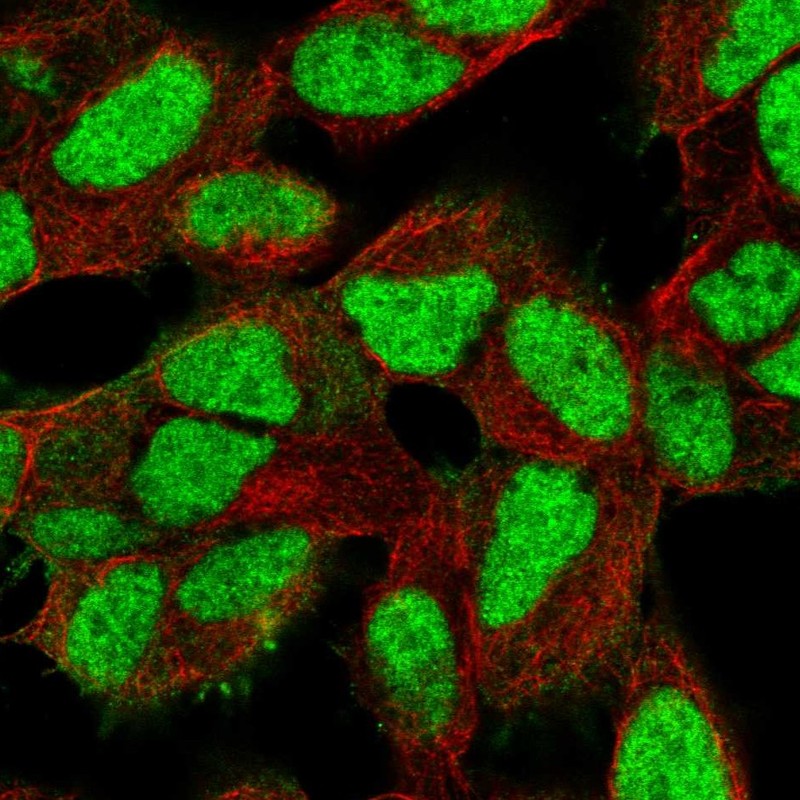 Atlas Antibodies Anti-XRCC5 Antibody